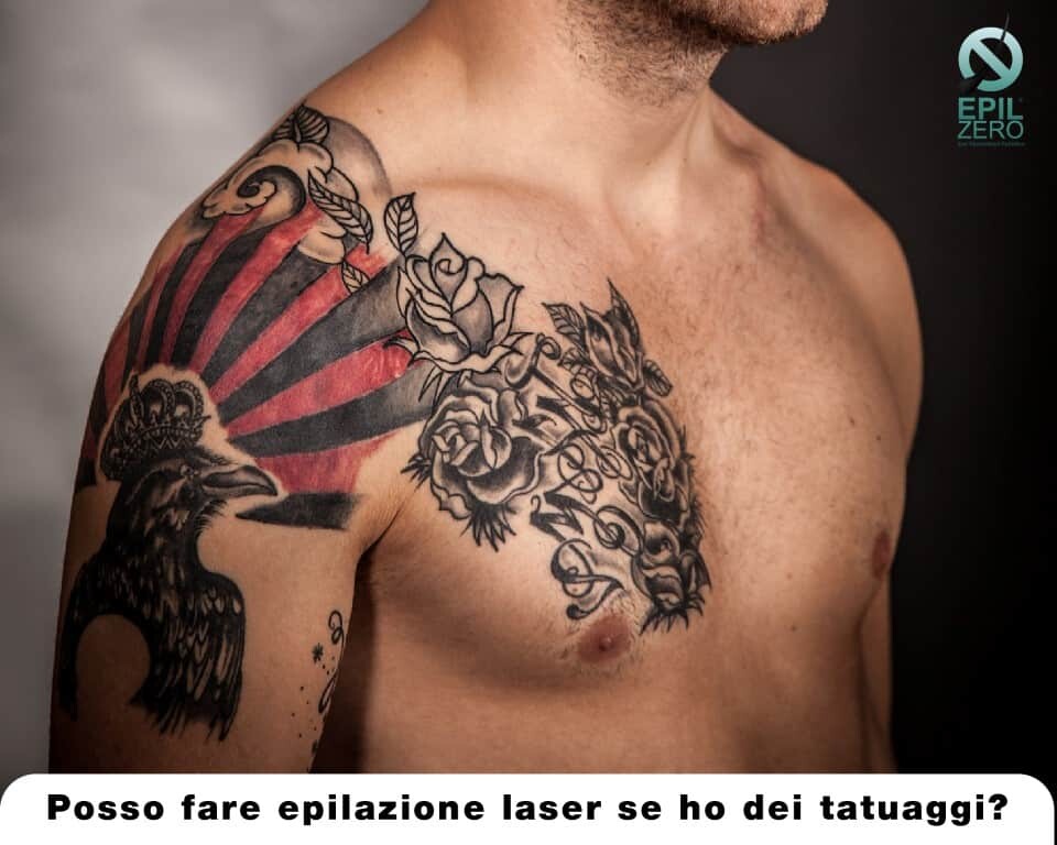 Posso fare epilazione laser se ho dei tatuaggi